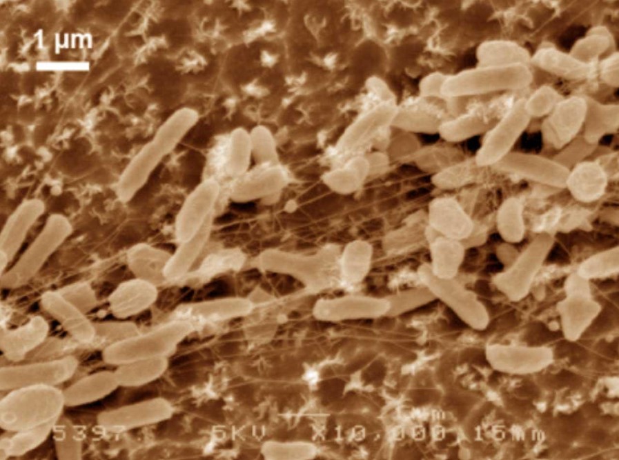 Figure 2 - Still image of Ideonella sakaiensis in false colour Scanning Electron Microscopy (Prostak, 2016).